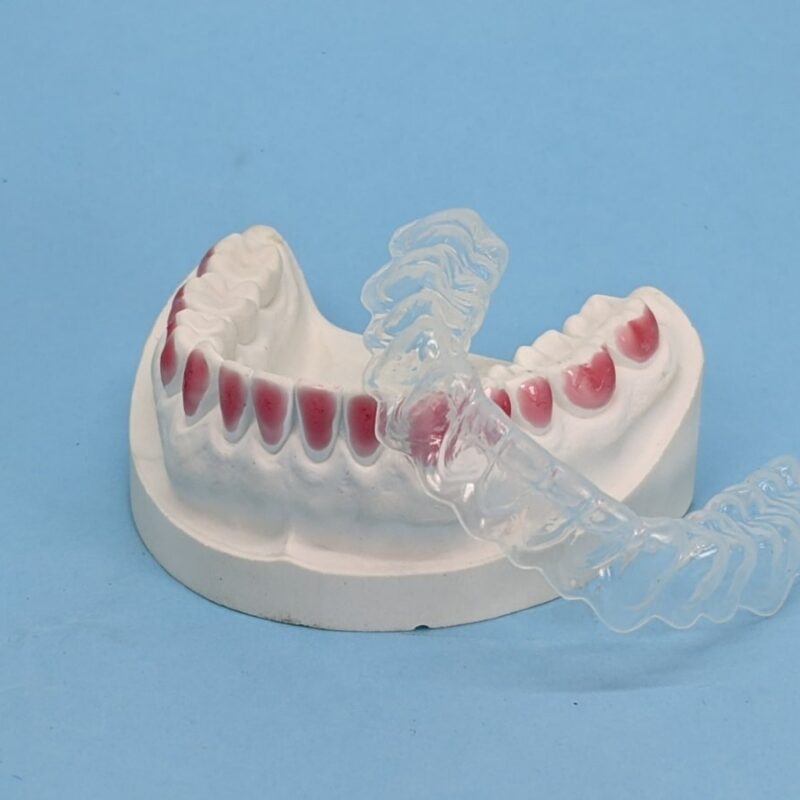 Bleaching Tray Shiken Manila Corporation