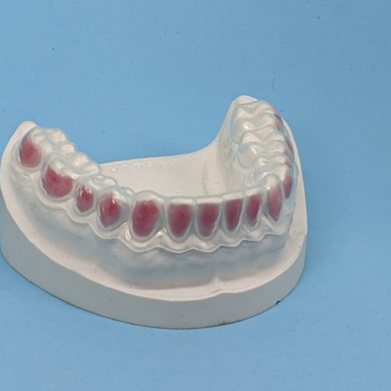 Bleaching Tray Shiken Manila Corporation