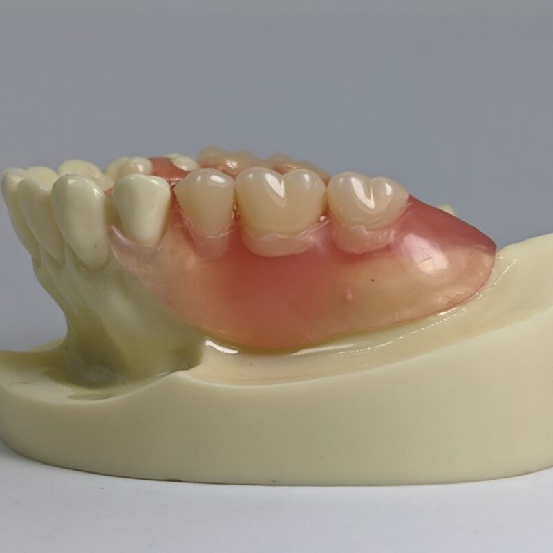 Flexible Dentures Shiken Manila Corporation